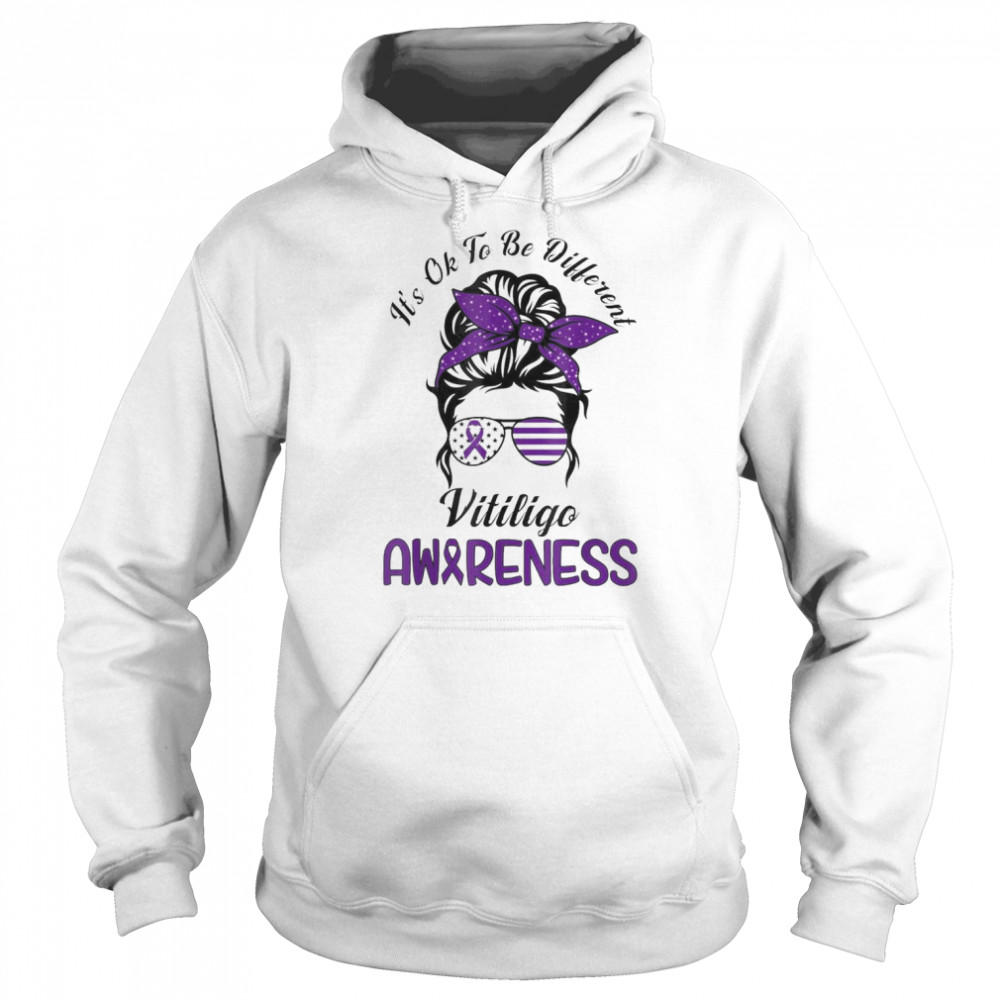 It’s Ok To Be Diferent Vitiligo Awareness Support Vitiligo Shirt Unisex Hoodie