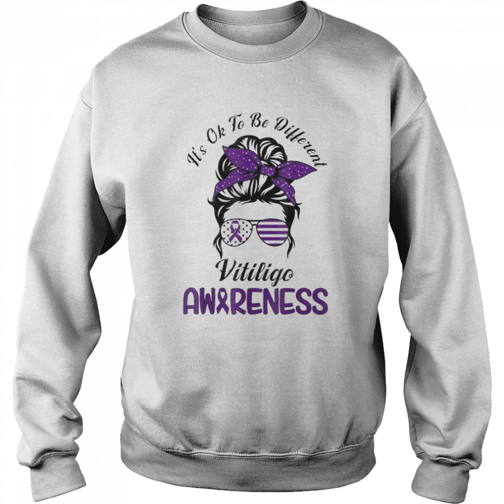 It’s Ok To Be Diferent Vitiligo Awareness Support Vitiligo Shirt Unisex Sweatshirt